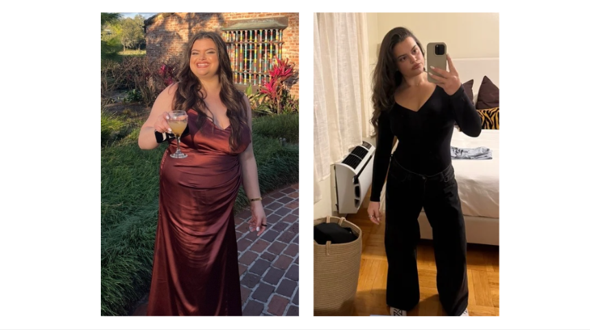 After Diets and GLPs Fail, Woman Drops 60 Pounds with Less-Invasive Endoscopic Procedure
